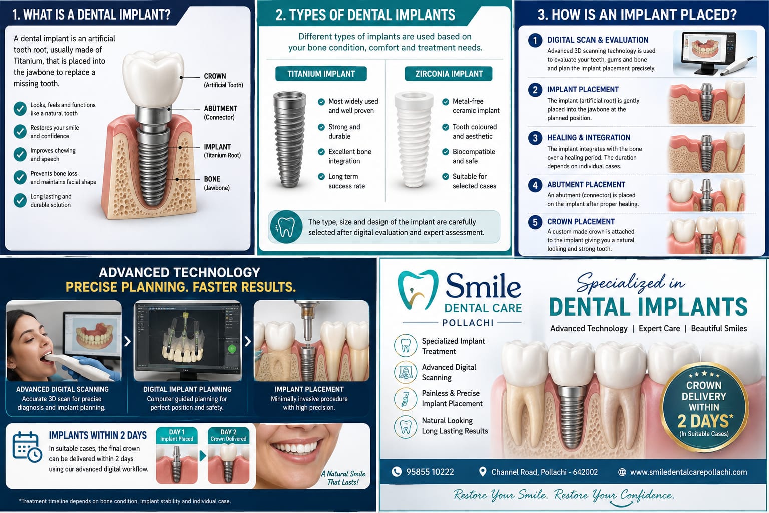 Dental Implant Digital Planning at Smile Dental Care