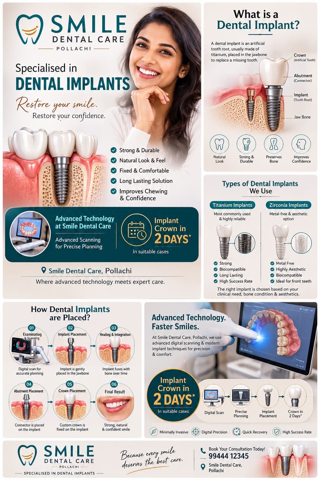 Specialists in Dental Implants