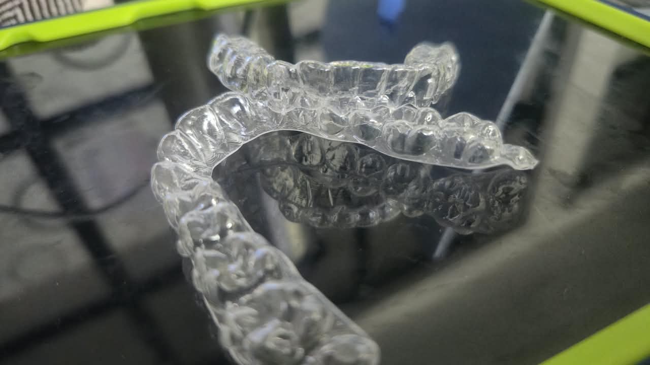 Clear Aligners photo 4