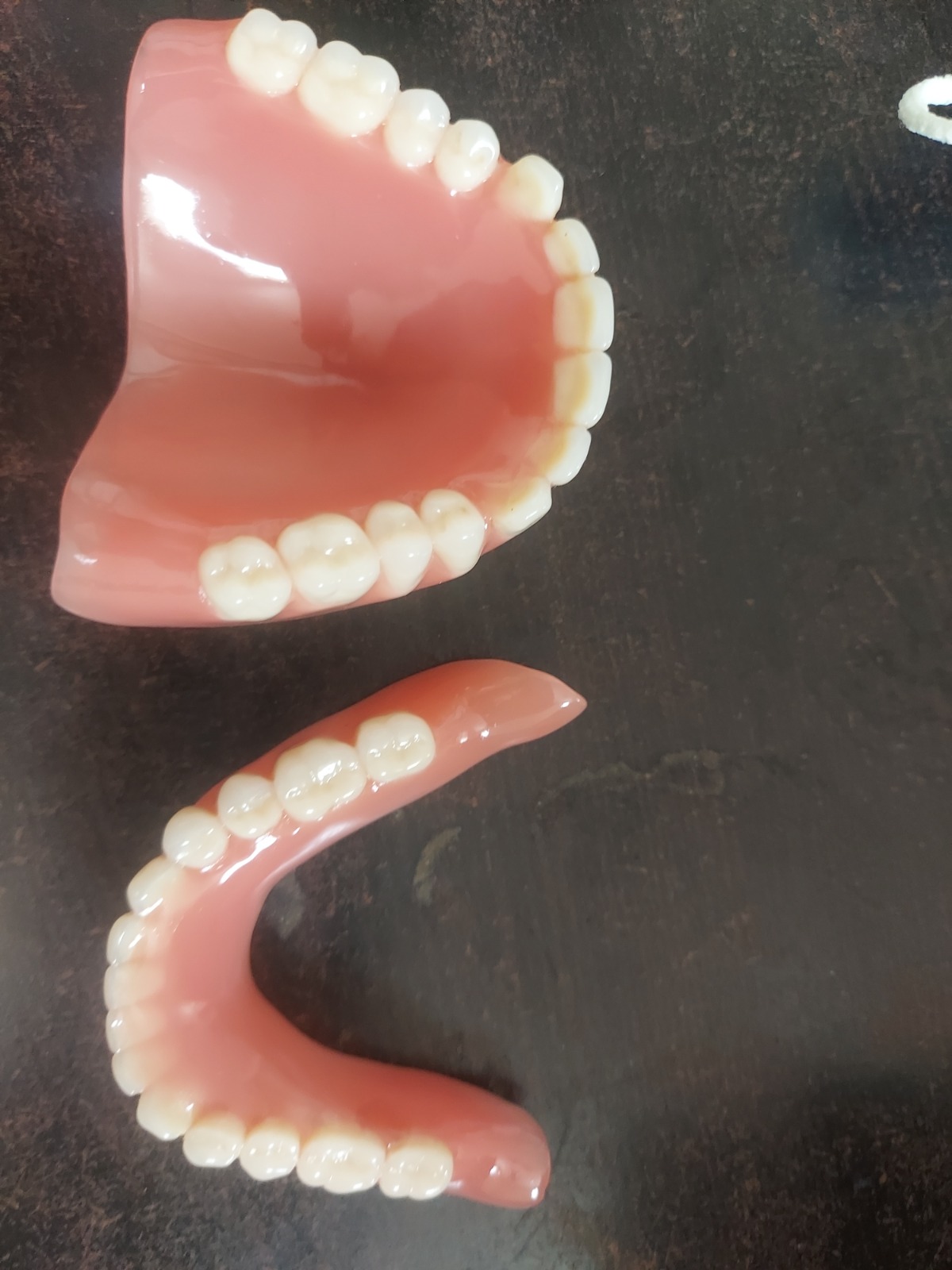 Dentures photo 2