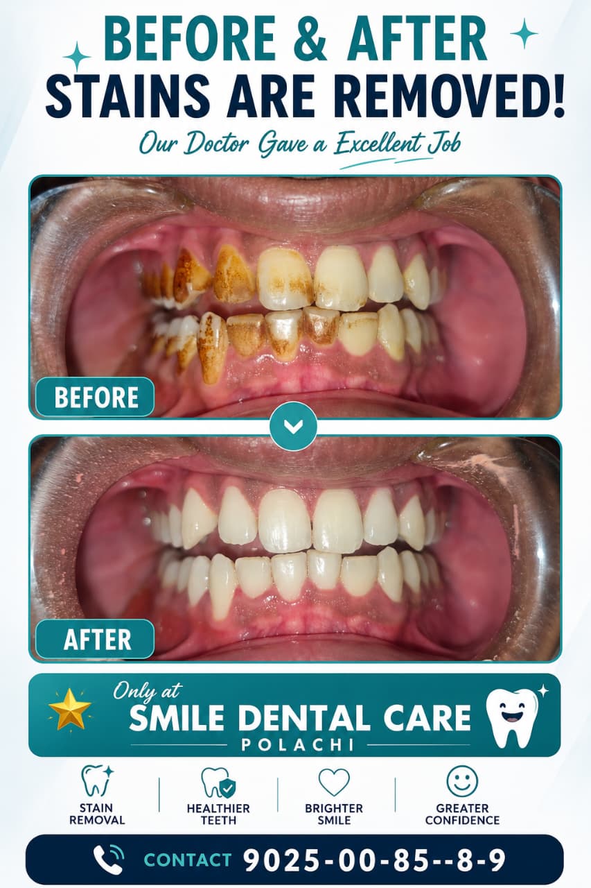 Scaling treatment photo