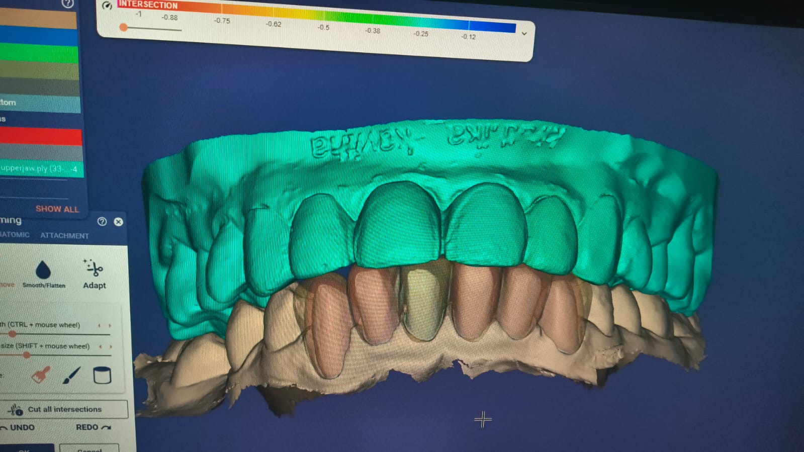 Smile Designing photo 1