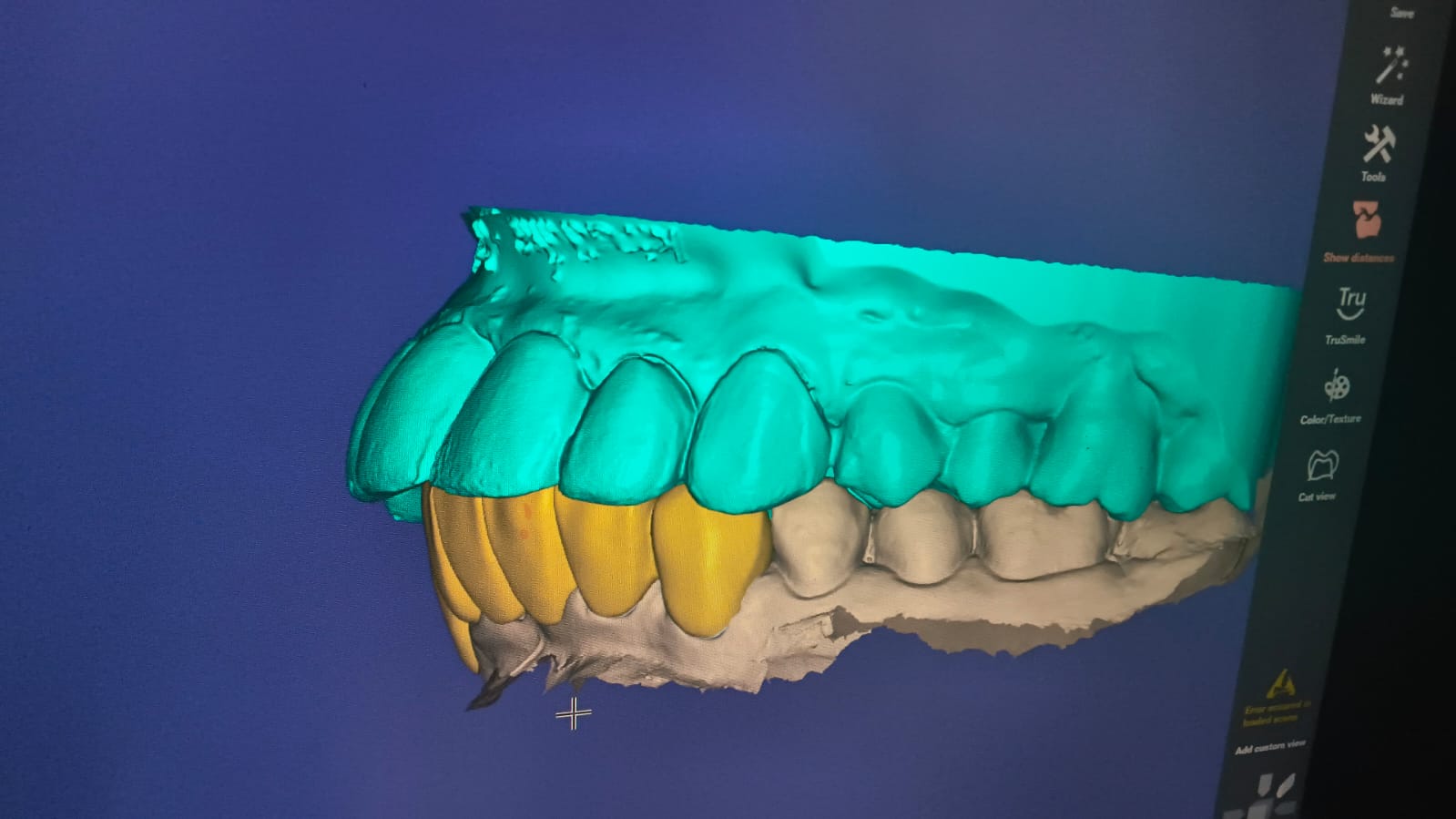 Smile Designing photo 11