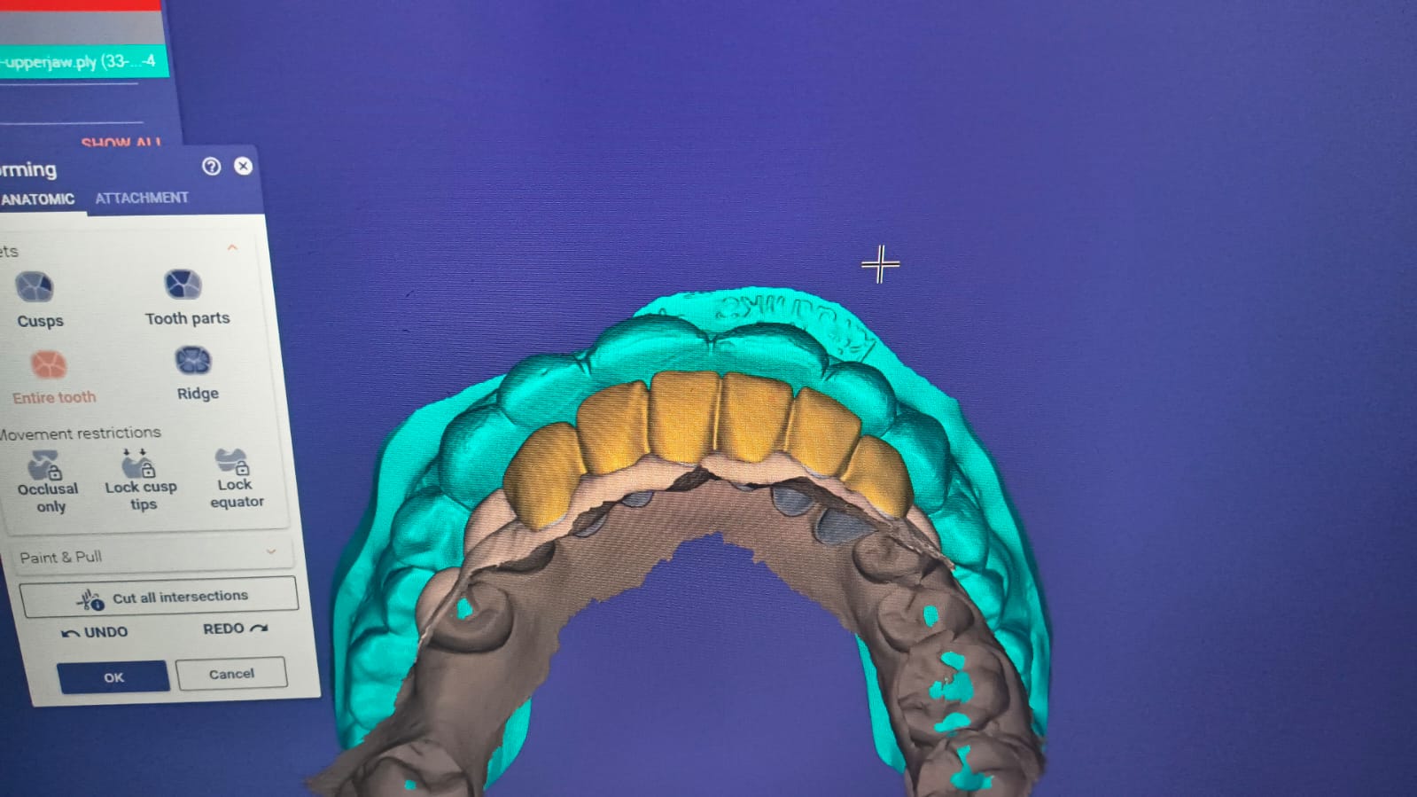 Smile Designing photo 2