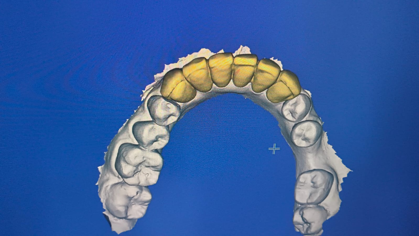Smile Designing photo 4