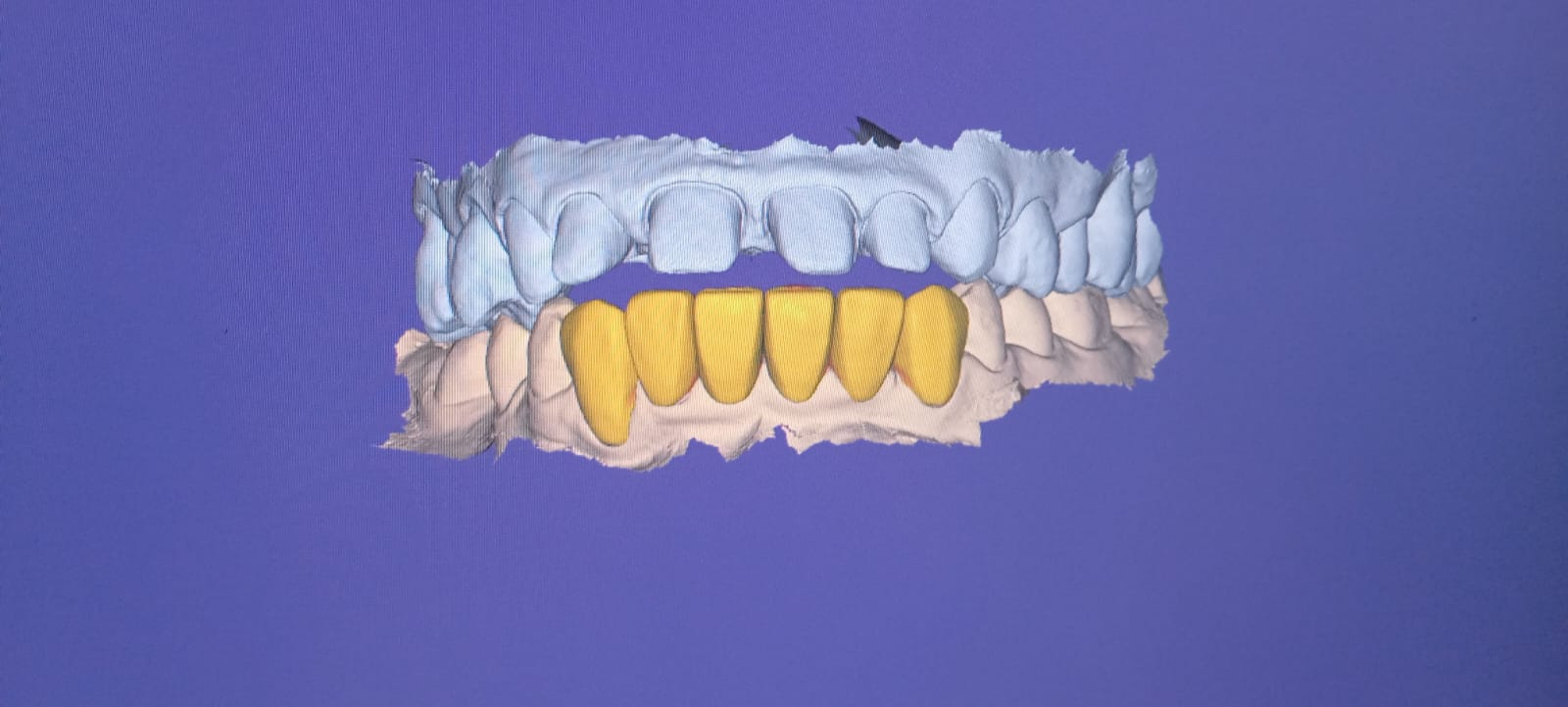 Smile Designing photo 5