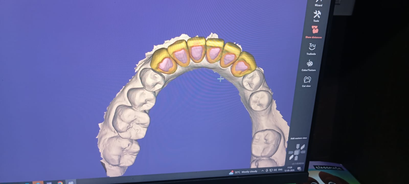 Smile Designing photo 6