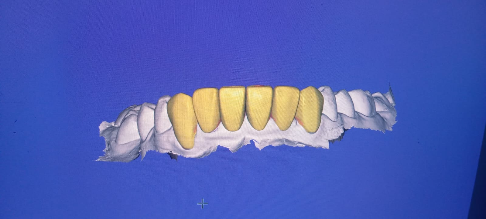Smile Designing photo 7