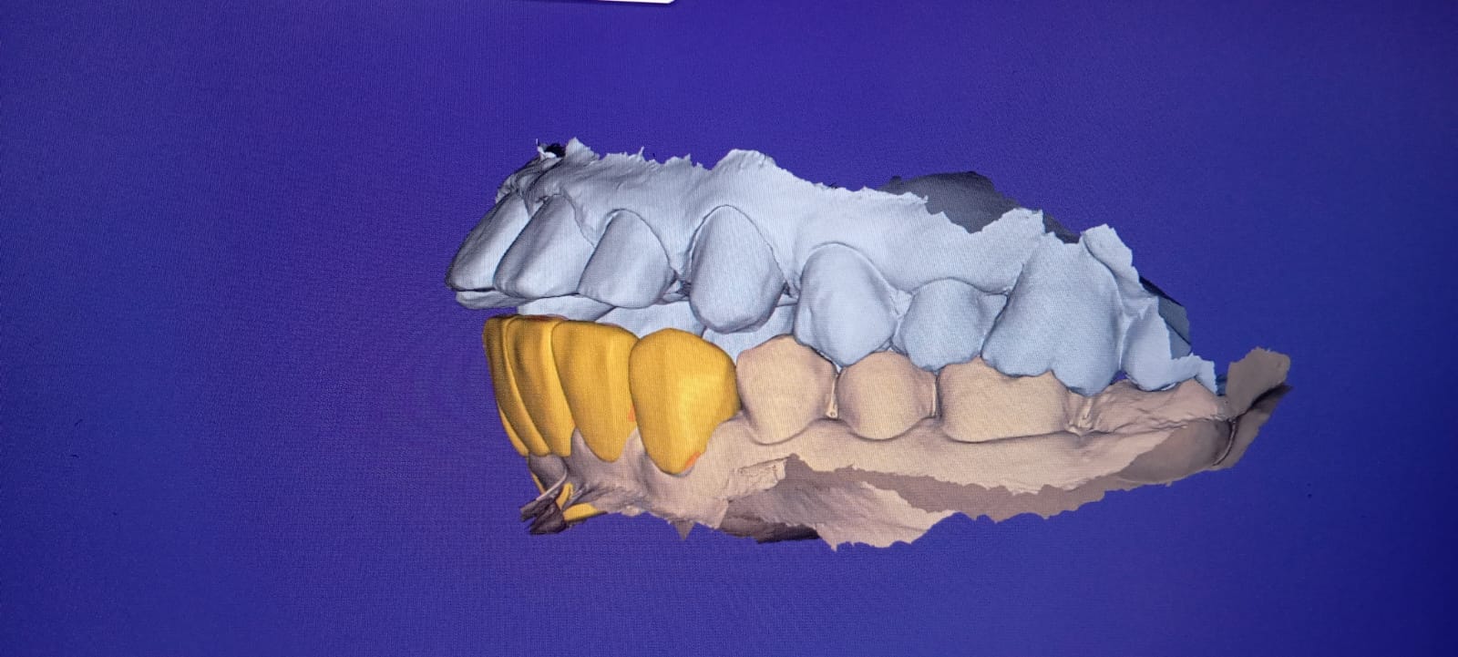 Smile Designing photo 9