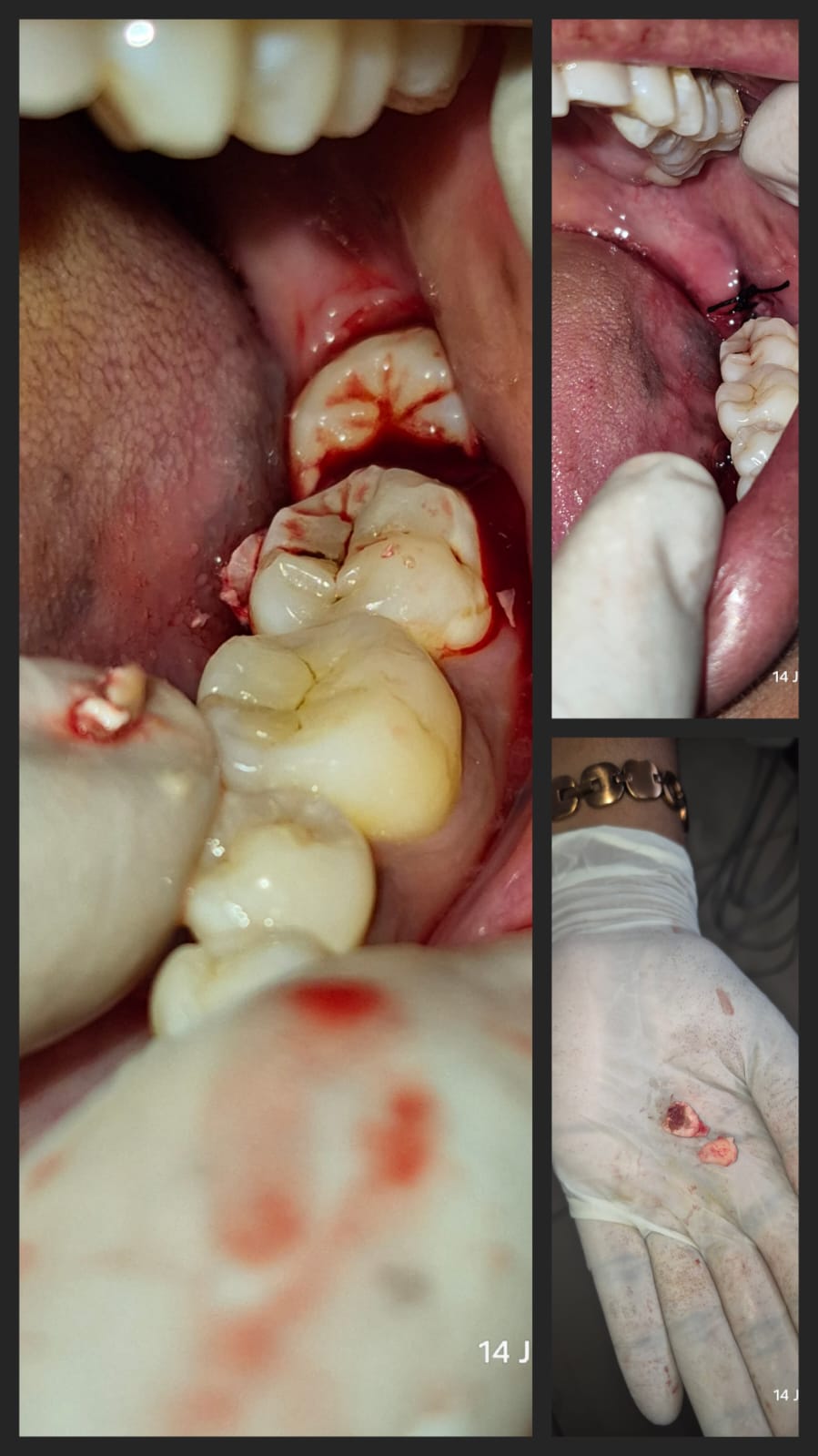 Dental Surgery photo